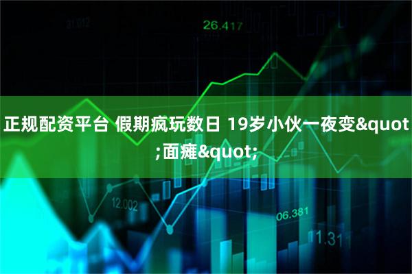 正规配资平台 假期疯玩数日 19岁小伙一夜变"面瘫"